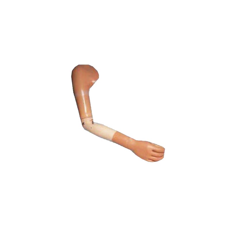 Žastikaulio (virš alkūnės) protezas